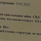 Это вот 25.06 по узи было