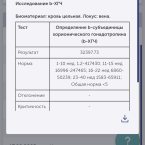В динамике за 48 часов 
В понедельник и сегодня сдавала